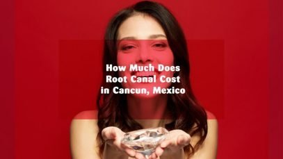 How much does Root Canal cost in Cancun, Mexico?