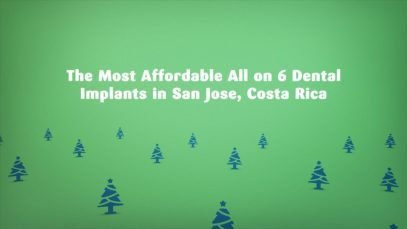 The Most Affordable All on 6 Dental Implants in San Jose, Costa Rica