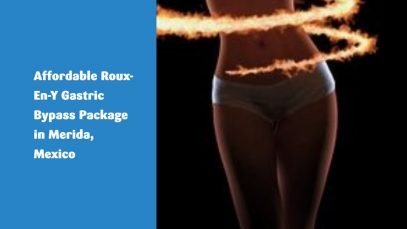 Affordable Roux-En-Y Gastric Bypass Package in Merida, Mexico