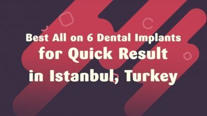 Best All on 6 Dental Implants for Quick Result in Istanbul, Turkey