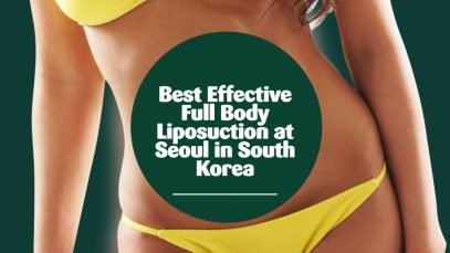 Best Lower Body Liposuction Package in Seoul, South Korea