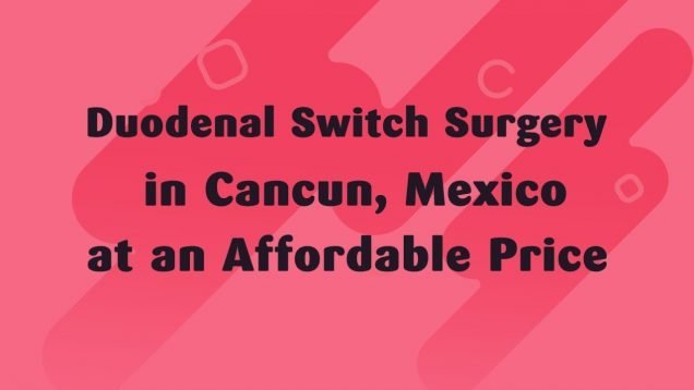 Duodenal Switch Surgery in Cancun, Mexico at an Affordable Price