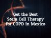 Get the Best Stem Cell Therapy for COPD in Mexico