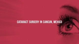 Popular Package for Cataract Surgery in Cancun, Mexico