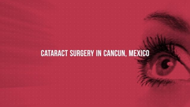 Popular Package for Cataract Surgery in Cancun, Mexico