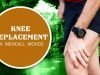 Suitable Package for Knee Replacement in Mexicali, Mexico