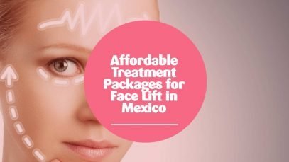 Affordable Treatment Packages for Face Lift in Mexico
