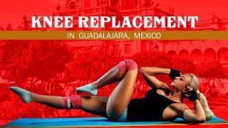 Get Suitable Package for Knee Replacement in Guadalajara, Mexico