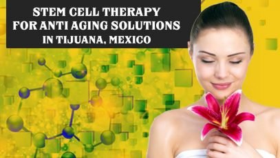Affordable Package for Stem Cell Therapy for Anti Aging Solutions in Tijuana, Mexico