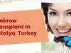Best Eyebrow Transplant in Antalya, Turkey
