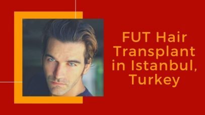 Best FUT Hair Transplant in Istanbul Turkey