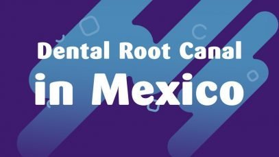 Dental Root Canal in Mexico