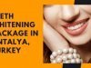 Get Affordable Teeth Whitening Package in Antalya, Turkey