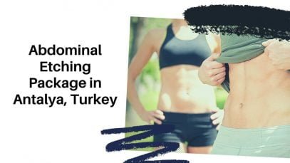 Top Abdominal Etching Package in Antalya, Turkey