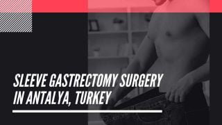 Top Sleeve Gastrectomy Surgery in Antalya, Turkey