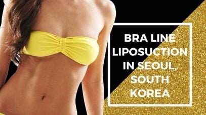 Most Popular Package for Bra Line Liposuction in Seoul, South Korea