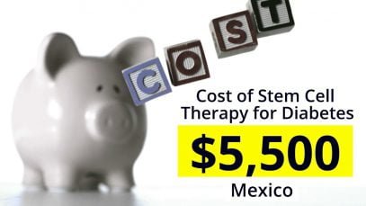 Stem Cell Therapy for Diabetes in Mexico- Find the Best Package