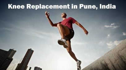 Suitable Package for Knee Replacement in Pune, India