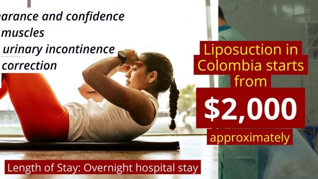 Best Liposuction Surgery Package in Colombia