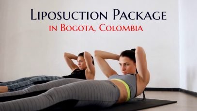 Tempting Package for Liposuction in Bogota, Colombia