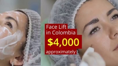 Face Lift Cosmetic Surgery Package in Colombia