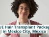 FUE Hair Transplant Package in Mexico City, Mexico