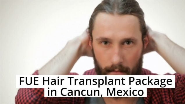 Get Amazing Package for FUE Hair Transplant in Cancun, Mexico