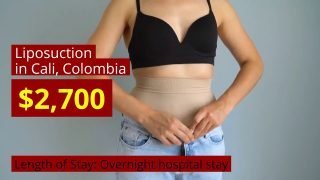 Liposuction Treatment Options in Cali, Colombia