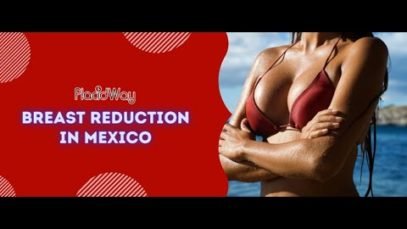 Essential Guide for Breast Reduction in Mexico