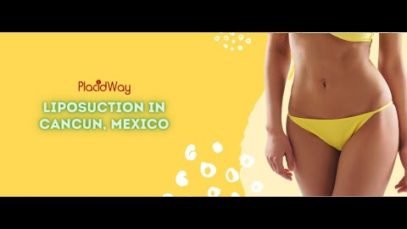 Essential Guide for Liposuction in Cancun, Mexico