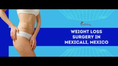 Feel Confident with Weight Loss Surgery In Mexicali, Mexico