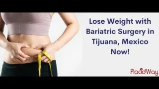 Weight Lose with Bariatric Surgery in Tijuana, Mexico