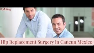 Hip Replacement Surgery in Cancun Mexico