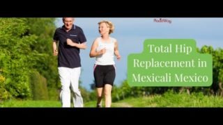 Total Hip Replacement Surgery in Mexicali Mexico