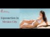 High Quality Liposuction in Mexico City Mexico