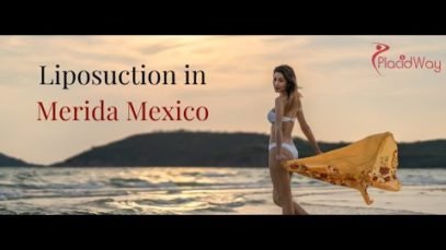 Remove Access Fat with Liposuction in Merida Mexico
